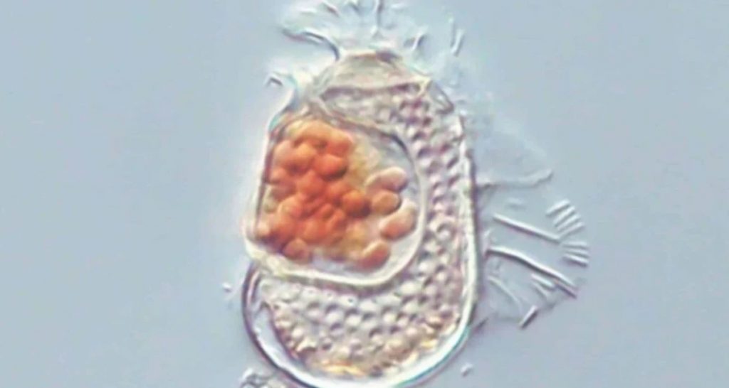 Imagen extraída de microscopio de Sukunaarchaeum mirabile